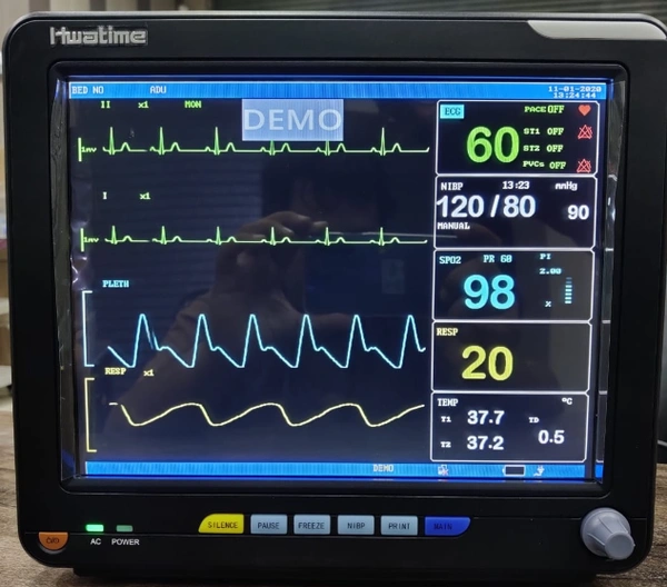 5 Para Patient Monitor